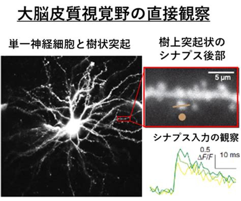 +Inversion Loop Forms at Synapsis に対する画像結果