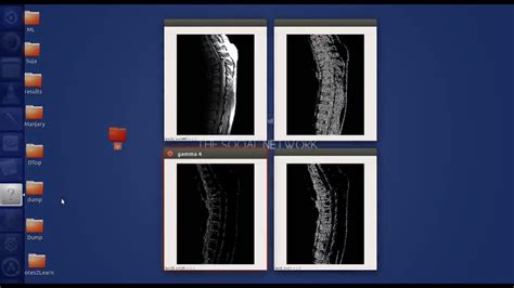 Toradh íomhá ar 3D Image Processing Python