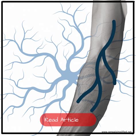 Radial GIF に対する画像結果