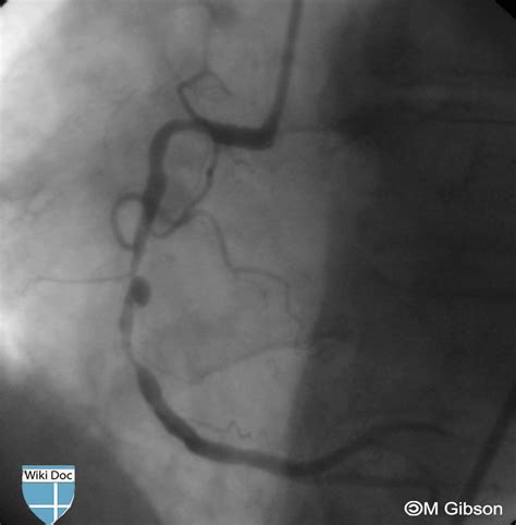 Image result for Grade 7 Math Algebraic Expressions Worksheets