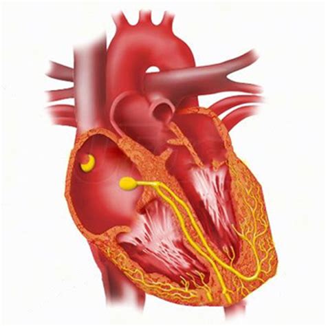 Image result for LBB ECG