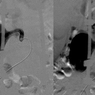 Toradh íomhá ar Examples of Left to Right Algorithm Subtraction