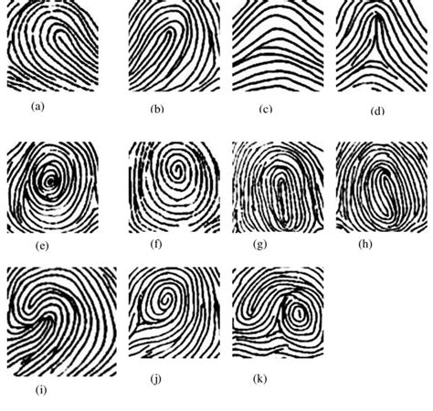 Image result for Accidental Loop Fingerprint Pattern