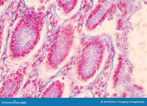 Afbeeldingsresultaten voor Human Small Intestine Tissue