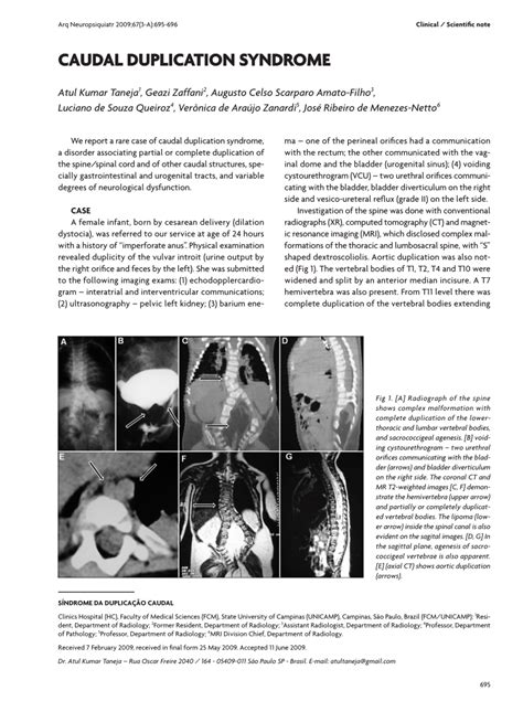 Image result for Duplication Disease