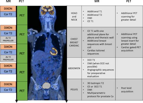 Machine Learning in Pet Scan Workflow に対する画像結果