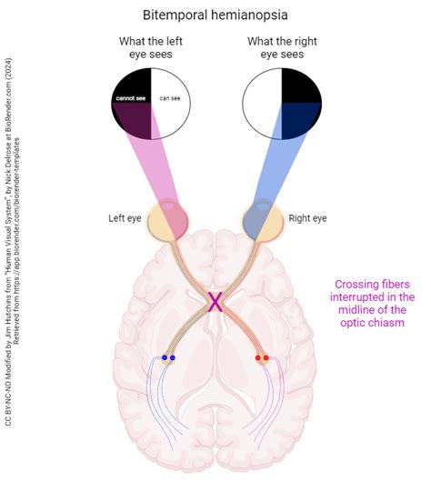 Image result for Visual Pathways in the Brain