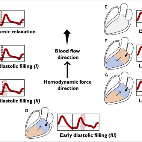 Image result for Intracavitaire Gradient