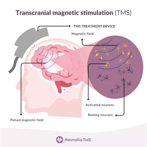 TMS Talent Management System に対する画像結果