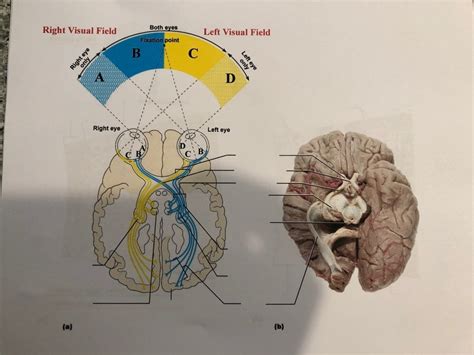 Visual Pathway Brain-साठीचा प्रतिमा निकाल