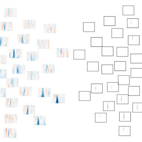 Afbeeldingsresultaten voor Peripheral Visual Field Defect