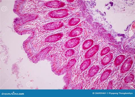 Afbeeldingsresultaten voor Human Small Intestine Tissue