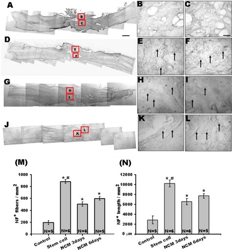 Image result for Rostral Dex