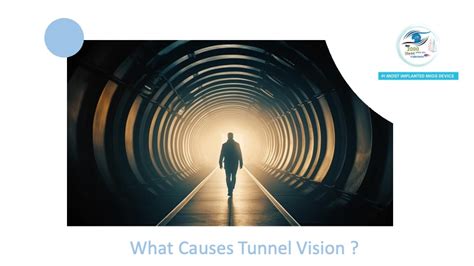 Tunnel Vision Visual Field Glaucoma に対する画像結果