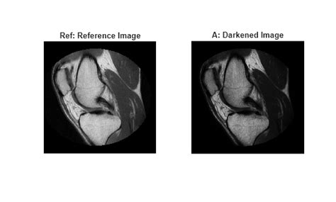 Afbeeldingsresultaten voor Imhist MATLAB