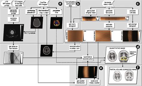 Machine Learning in Pet Scan Workflow に対する画像結果