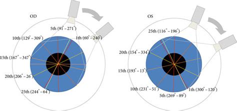 Image result for MATLAB Pentacam