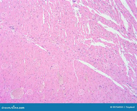 Heart Muscle Tissue に対する画像結果