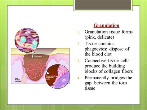 Granulation Tissue に対する画像結果