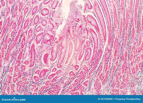 Afbeeldingsresultaten voor Human Small Intestine Tissue