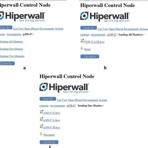 Afbeeldingsresultaten voor Peripheral Visual Field Defect
