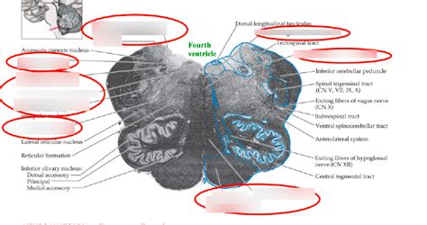 Image result for Rostral Dex