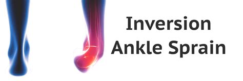 Image result for Inversion Ankle Injury