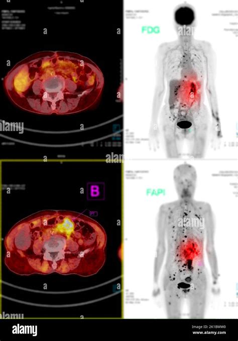 Afbeeldingsresultaten voor Pet Scan Process