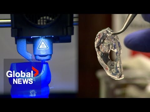 “Game changer”: 3D-printing breakthrough could transform chronic lung disease