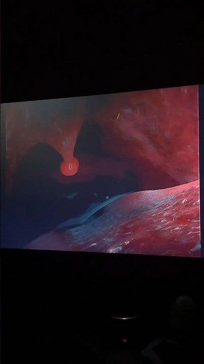 Finding Nemo Whale Uvula