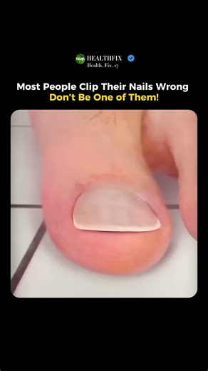 Stop Cutting Your Toenails Wrong! Prevent Ingrown Nails With This Simple Trick #shorts #healthtips