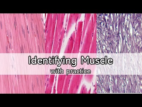 Identifying Muscle | Review and Practice