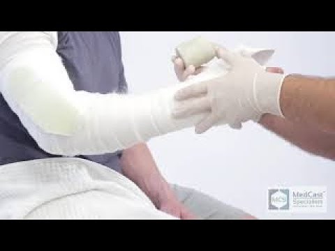 How to apply a MUENSTER CAST - Plus Cast Removal