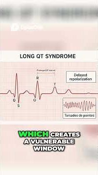 Sudden Cardiac Death in Athletes ⚡️ | 5 ECG Patterns You Must Know #doctorexplains