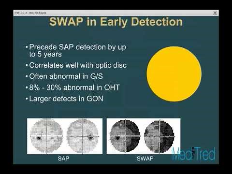 Full Lecture: Visual Field Testing