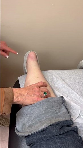 Diagnosing a Torn Achilles' Tendon Tear