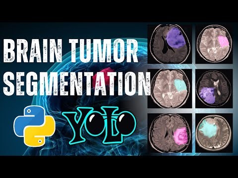 Brain Tumor Segmentation using YOLOv9 | Deep Learning Medical AI