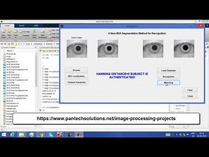 Matlab code for Iris Recognition -Image Processing projects