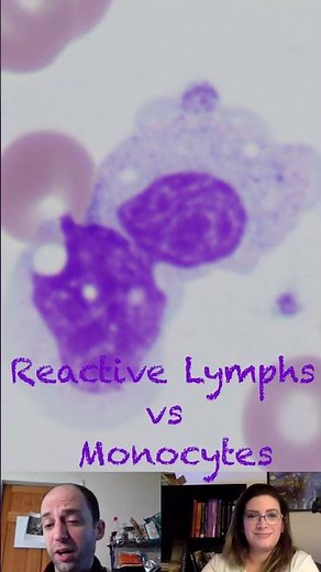 Reactive Lymphocytes versus Monocytes