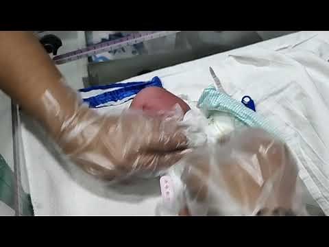 How to change nappy of a newborn (girl).