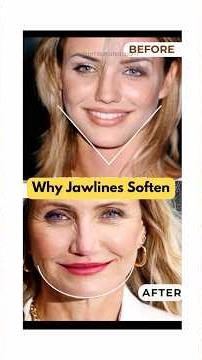 When Did Your Jawline Turn from V-Shape to U-Shape? (It’s Not Just Age)