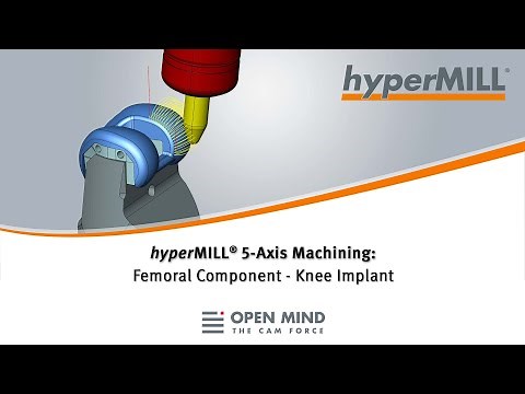 hyperMILL 5-Axis Machining: Femoral Component – Knee Implant | CAM-Software