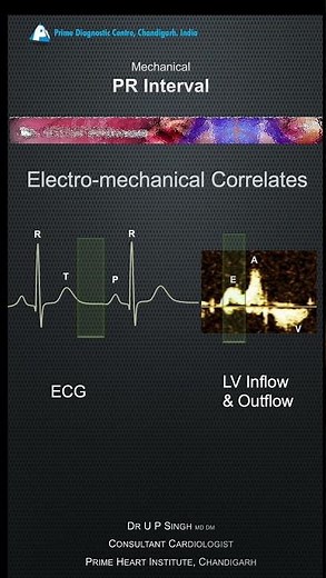 How to take PR interval on fetal echocardiography #printerval