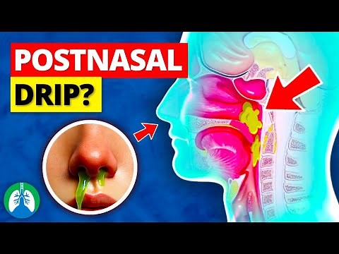 Postnasal Drip | Causes, Symptoms, and Treatments