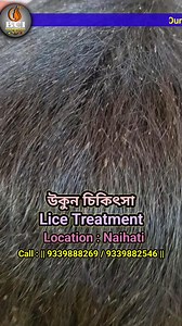 4.4K reactions · 138 shares | || LICE TREATMENT || BOOK AN APPOINTMENT || CALL:9339888269 || Address: 5/4 RBC ROAD,NAIHATI, WEST BENGAL. NORTH 24 PARGANAS,PIN-743165, Naihati, India, West Bengal.(Near Bank of Baroda | BCI Makeup Academy & Salon | Facebook