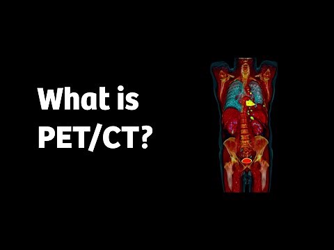 What is PET/CT and how does it work?