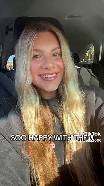 go to @SMILE TIJUANA they are seriously the best!! | veneer