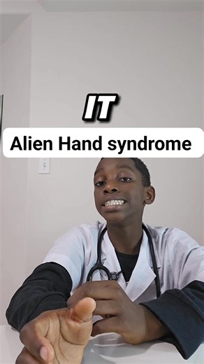 8 comments | *Ever heard of Alien Hand Syndrome? ️* It’s a rare...
