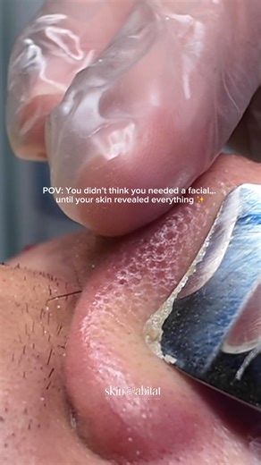 Your skin has been asking for this ✨ for appointments 👉🏻 09977033118 pin 📍 Sta. Rita, Guiguinto, Bulacan. #skinhabitat #facialtreatment #facial #hydrafacial | Skin Habitat