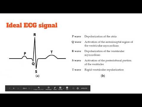 ECG signal filtrering
